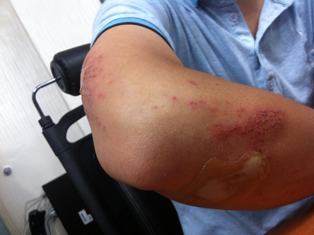 怪我を予防するためのセミナーは本当に効果的？