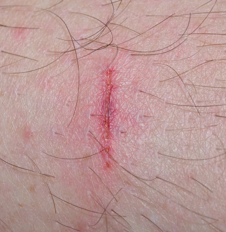 怪我の予防に効果的な方法は何ですか？