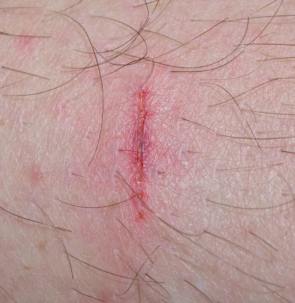 怪我の予防に効果的な方法は何ですか？